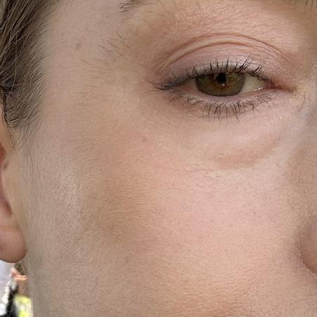 Close-up of a person's face with visible skin texture and eye.